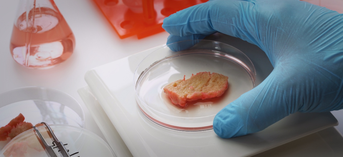 Is cultured meat the ‘new’ alternative to real meat: A dietitian's take