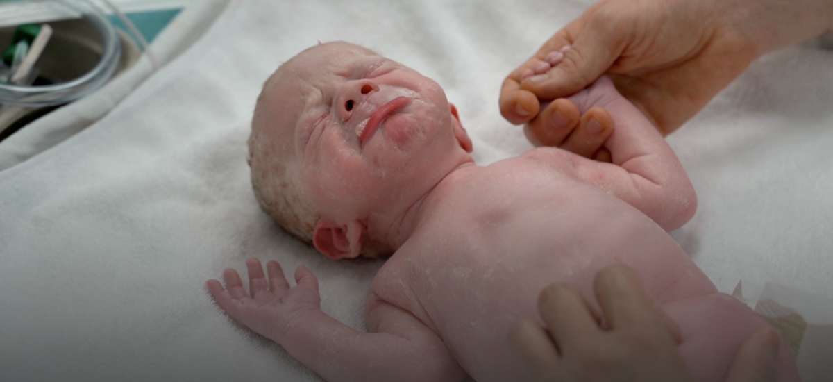 What happens when you go for a C-section?