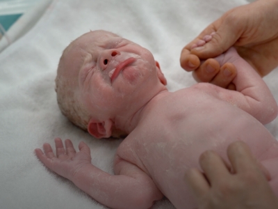 What happens when you go for a C-section?